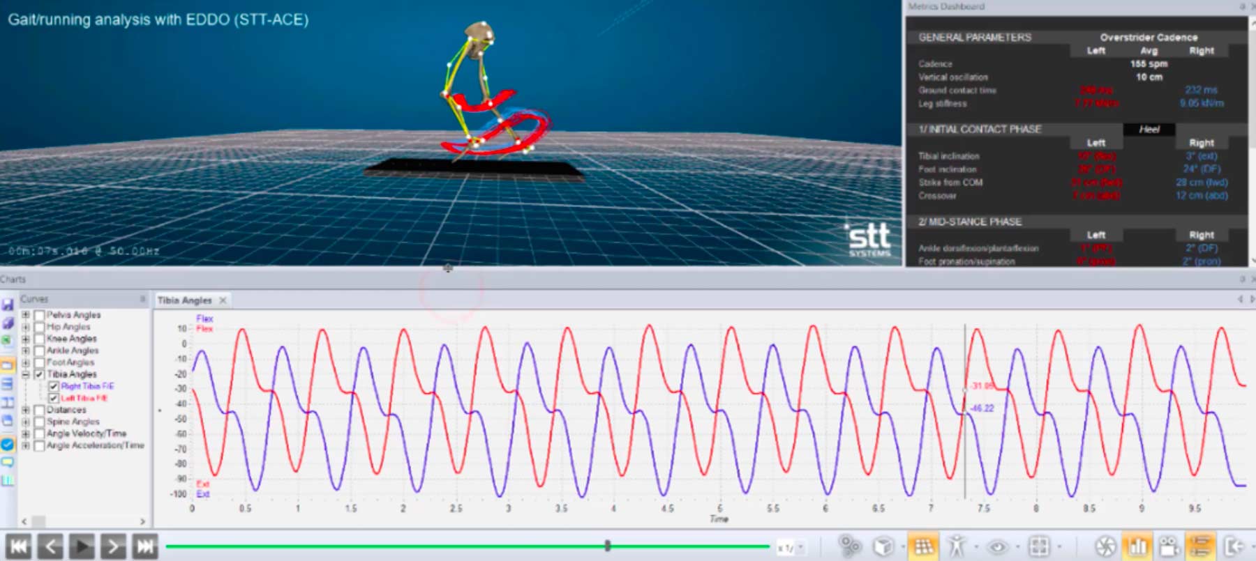 3D Running Gait Analysis - Better Motion