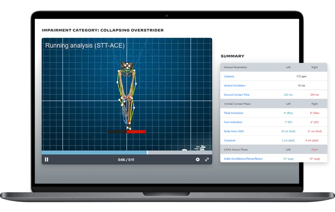 3D Running Gait Analysis - Better Motion